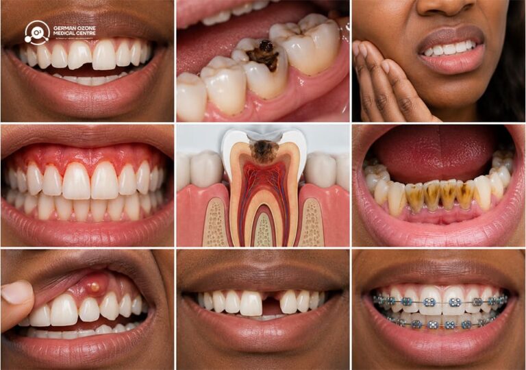 Nine-panel grid of dental conditions including cavities, gum disease, tooth decay, missing teeth, and braces.