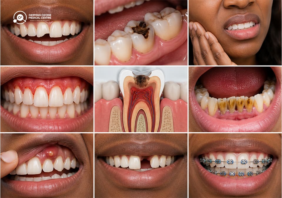 12 Common Dental Problems a General Dentist Can Treat Nine-panel grid of dental conditions including cavities, gum disease, tooth decay, missing teeth, and braces.